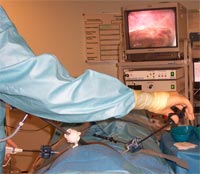 Laparoscopic Hernia Repair