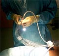 Abdomen Laparoscopy